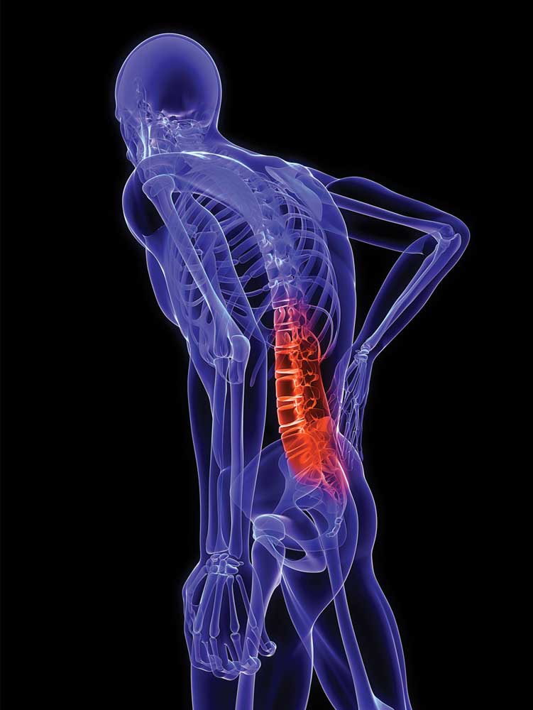 Sciatica Treatment - Randolph County Chiropractic